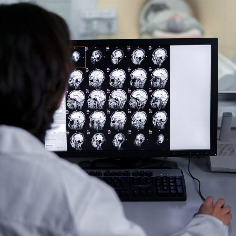 Como um software PACS pode otimizar a gestão de imagens médicas em sua clínica/hospital